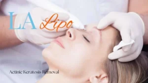 Woman receiving Actinic Keratosis Removal Treatment Burton upon Trent