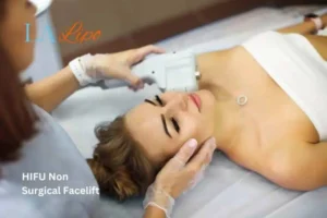 Woman having Hi-Fu to reduce wrinkles Burton upon Trent.