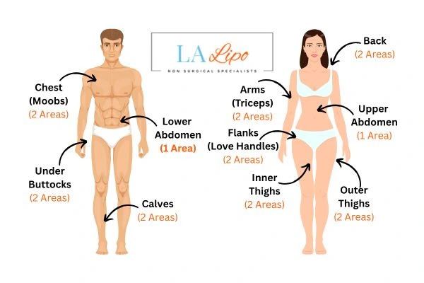 LA LIPO Cryolipolysis Areas Burton upon Trent