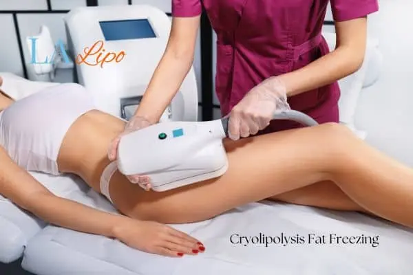 Woman receiving coolsculpting Burton upon Trent treatment on her thighs