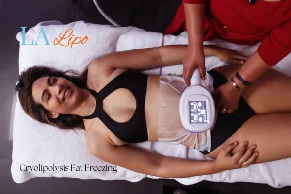 woman getting cryolipolysis Burton upon Trent