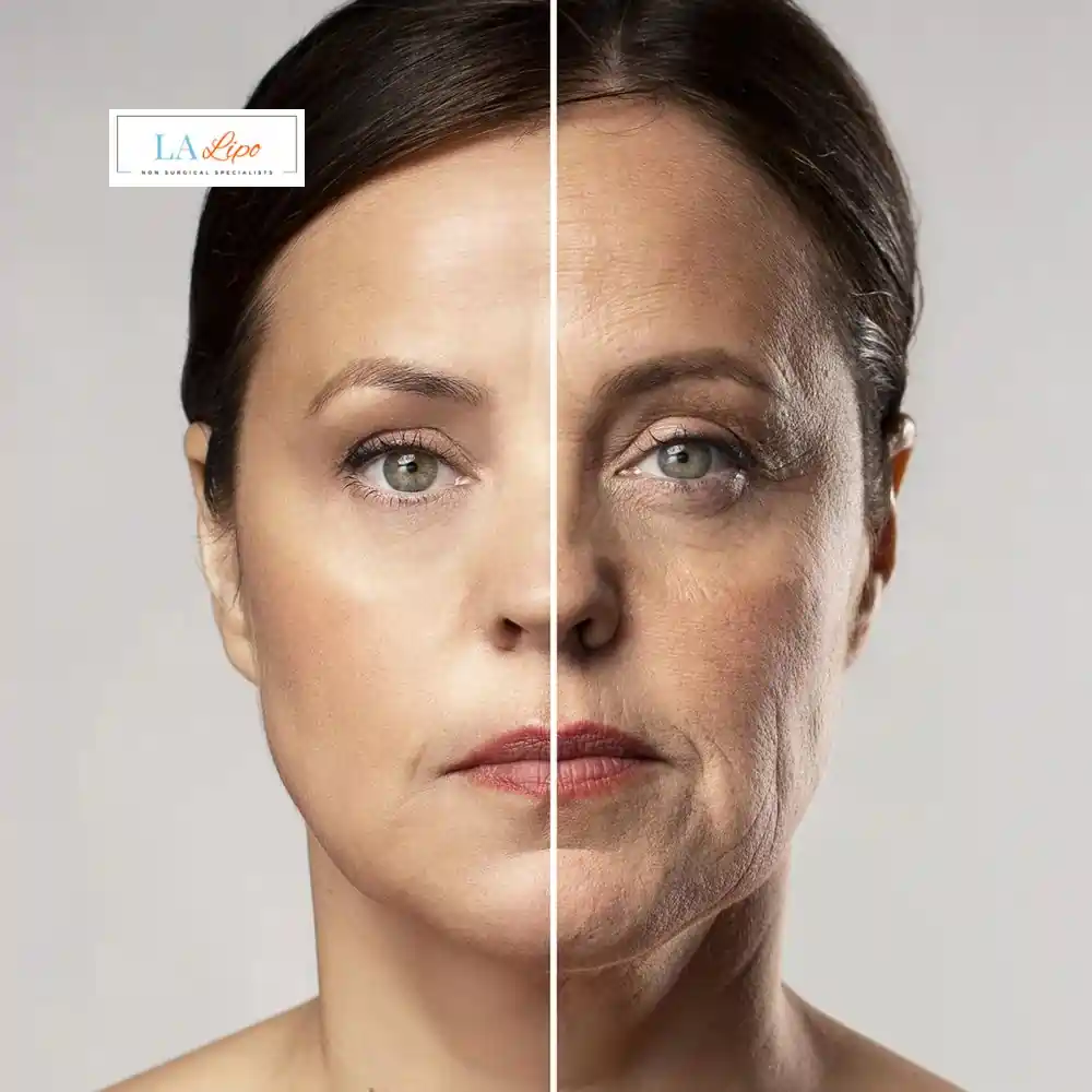 How Can You Tell If Non-Surgical Skin Tightening Is Right for You Burton upon Trent?